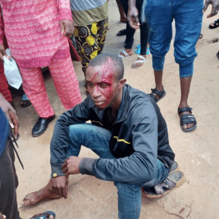 Angry Mob Beats Another Suspected Phone Thief in Nnewi, Breaks His Skull